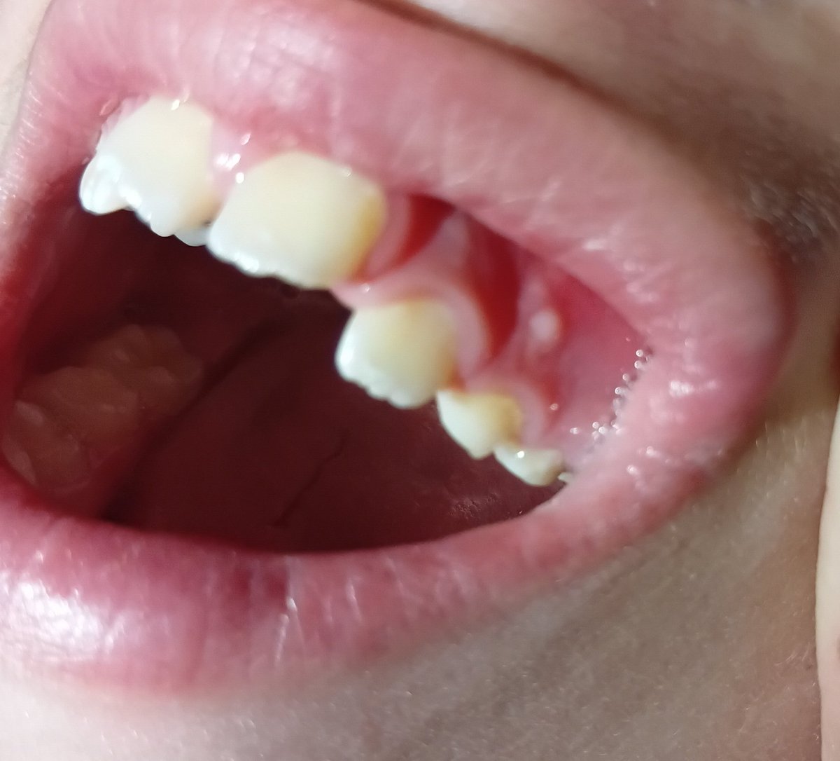 Rozeat Gaza🍉🇵🇸🇵🇸🇵🇸 tweet media