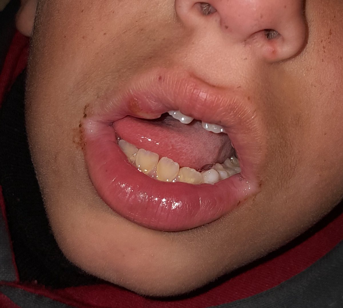 Rozeat Gaza🍉🇵🇸🇵🇸🇵🇸 tweet media