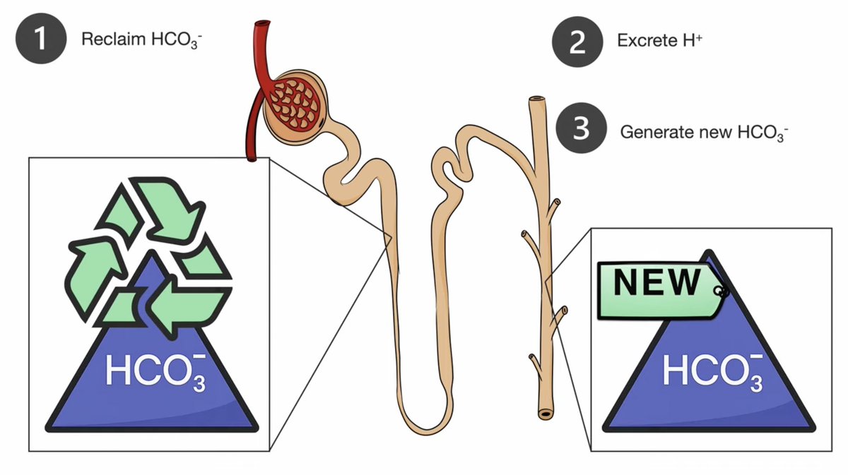 AbcKidney's tweet photo. ▶️ https://t.co/8ByVsn1clT
How do kidneys maintain acid–base balance?
3️⃣ key functions:
🧪 Reclaim filtered bicarb
⬆️ H⁺ secretion
➕ Generate new bicarb
🔬 Immersive learning @ https://t.co/UBcVSdAyYr
@ASNKidney #KidneyCure
#NephX #AcidBase #RenalPhysiology #MedEd #FOAMed https://t.co/K4L4DsQkrh