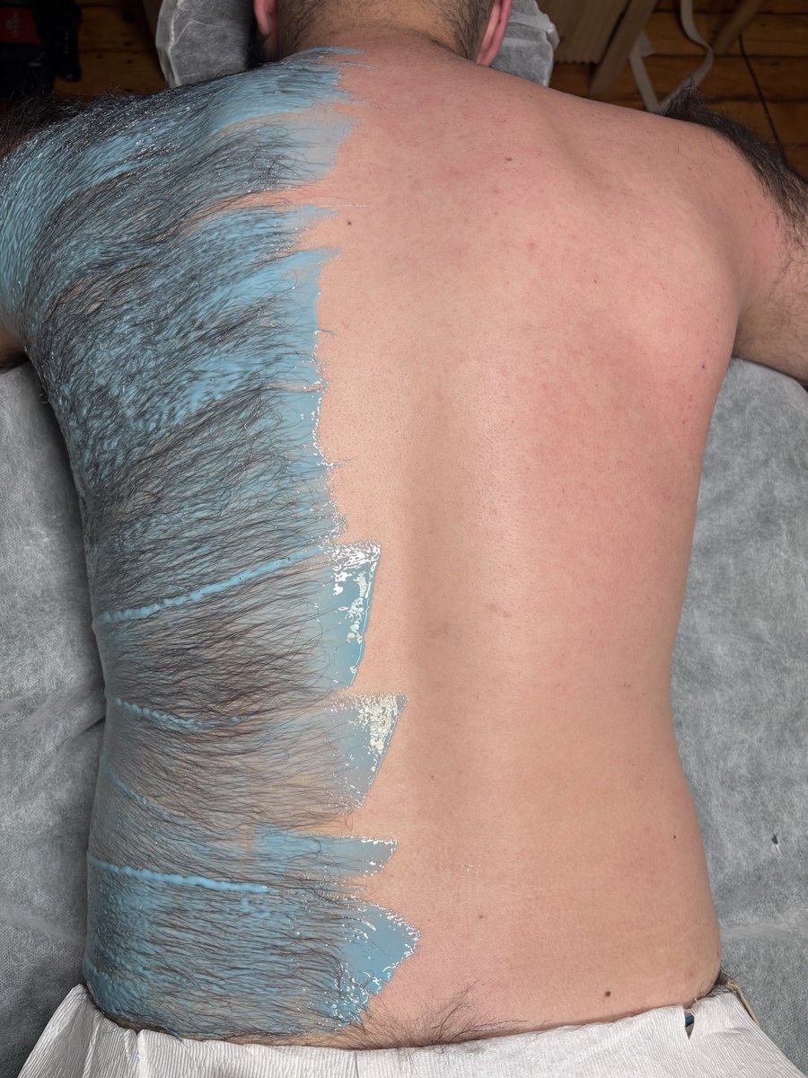 thebaremangroom's tweet photo. From BEAR to BARE!!!! No shirt season is right around the corner! Book your appointments now!
#wax #menswax #backwax #hairfree #back https://t.co/lqodyWidvv