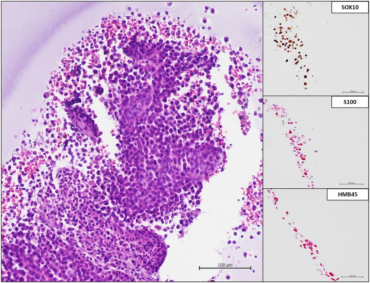 Cancer Cytopathology tweet media
