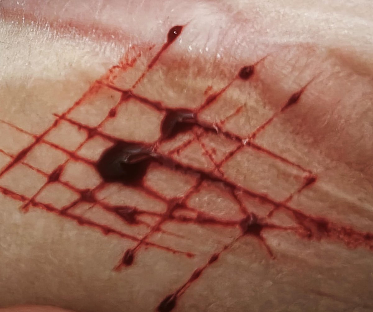 Boreeeedddddd #sh #selfharm #shtwt