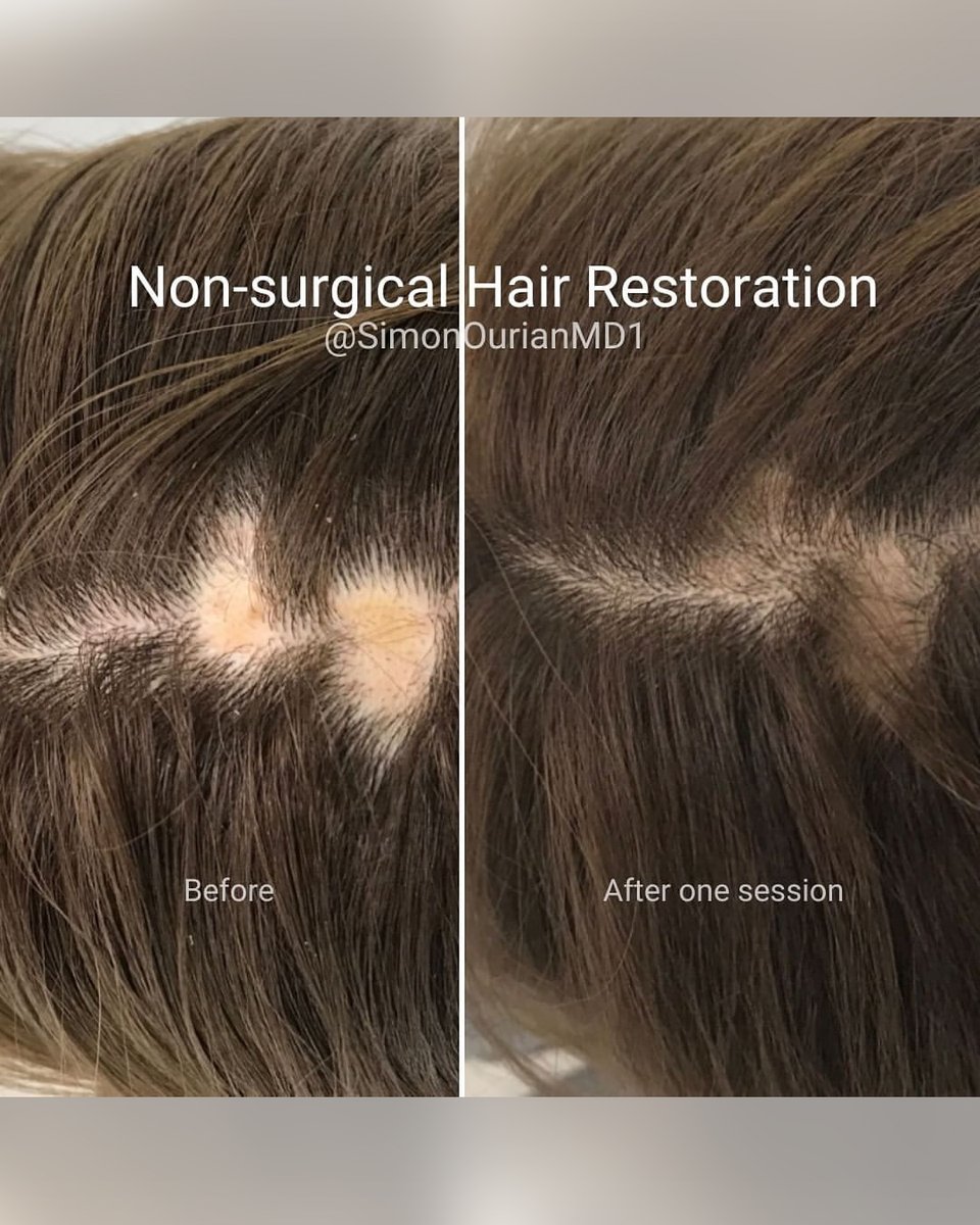 Dr. Simon Ourian - Epione tweet media