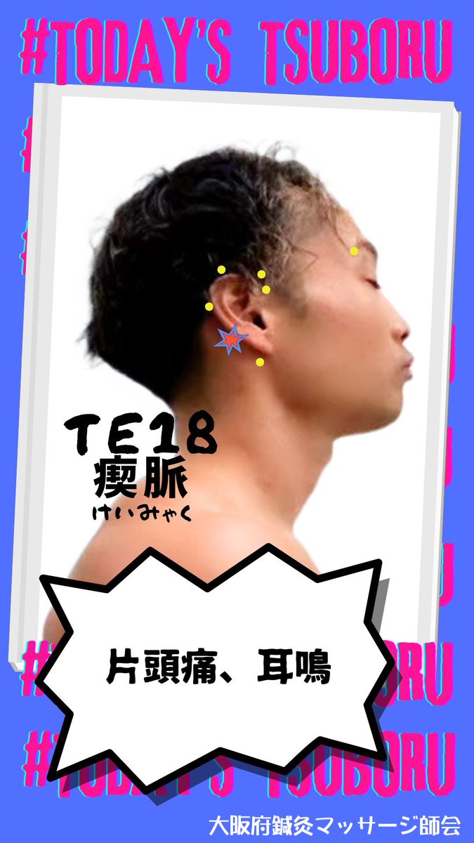 osmk_osaka's tweet photo. 今日のつぼる #瘈脈 #TE18
#大阪府鍼灸マッサージ師会
#大阪府東洋療法協同組合
#鍼灸マッサージちゃんねる
#今日のつぼる君
#鍼灸好きな人とつながりたい
#鍼灸 #マッサージ
#東洋医学 #ツボ
#健康 #未病
#セルフケア
#acupuncture https://t.co/YcjS2Hy4xK