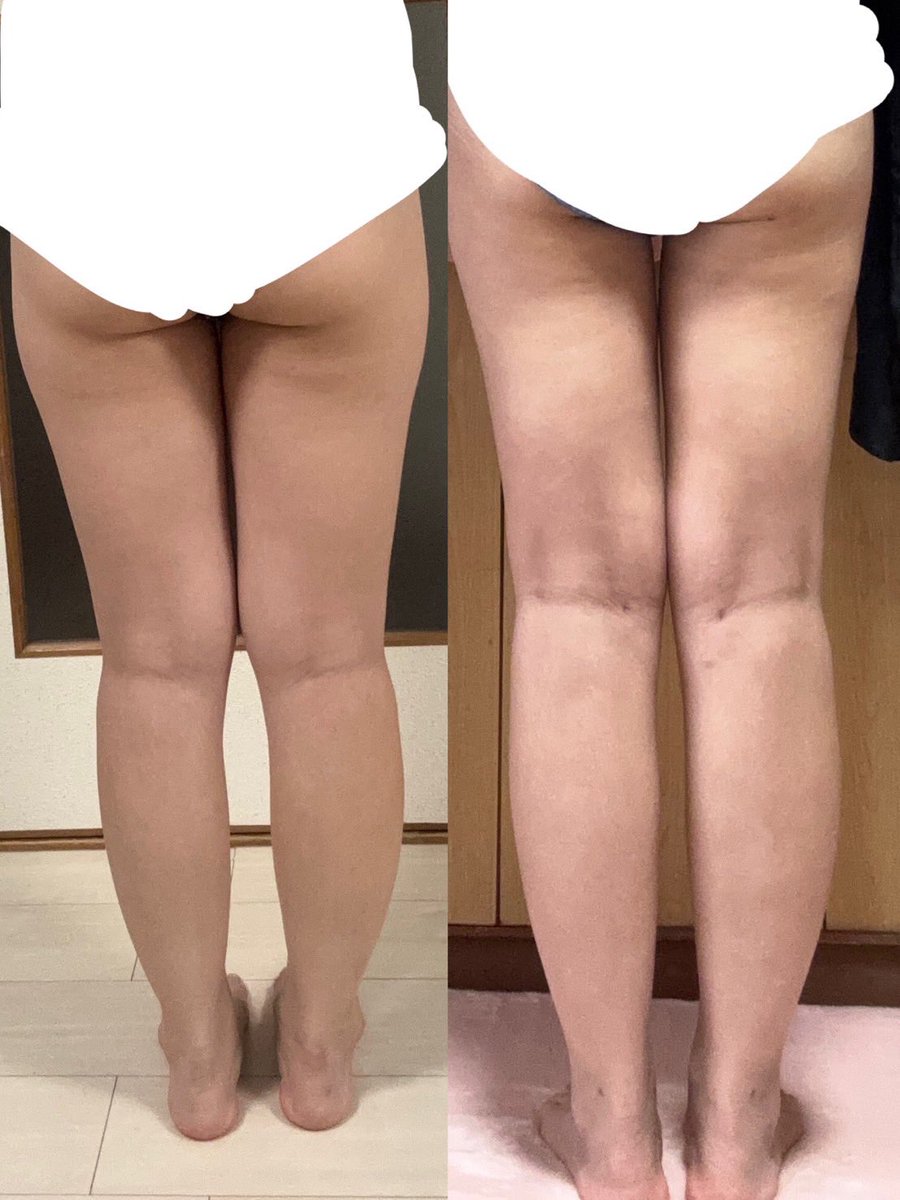 みゃん tweet media