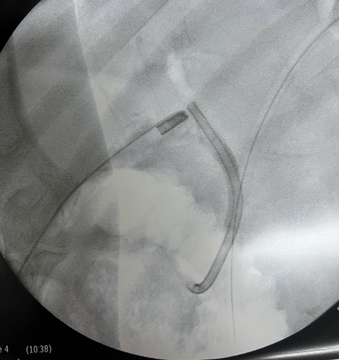 Juan David Espinoza tweet media