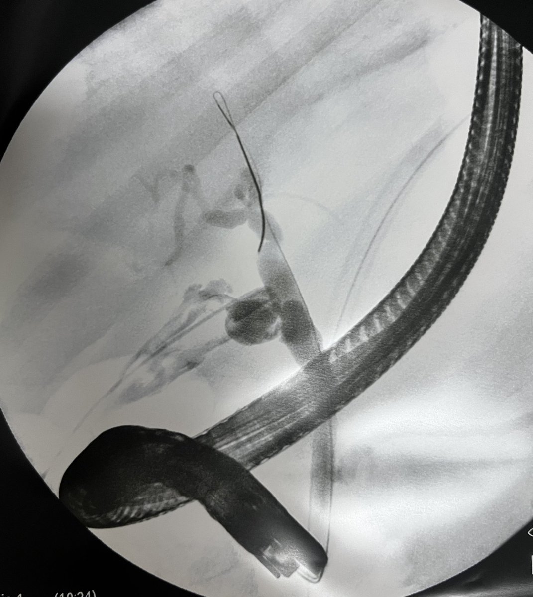 Juan David Espinoza tweet media