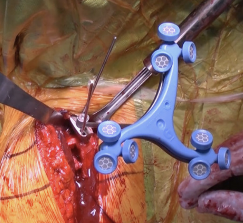 Rick Matsen tweet media