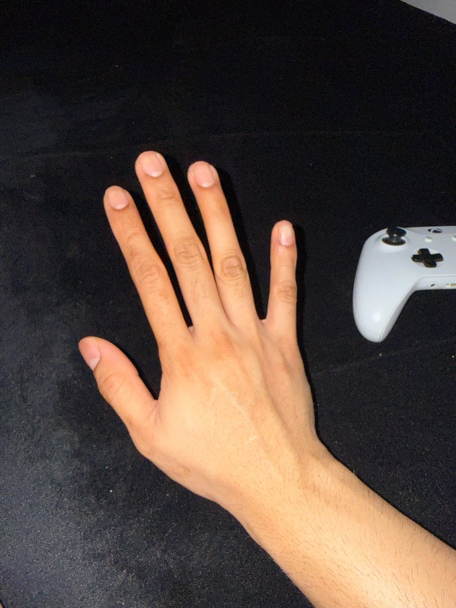 MYLO DENMRIND tweet media