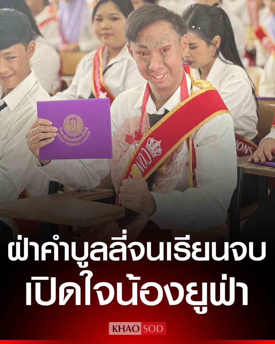 เปิดใจ น้องยูฟ่า ป่วยโรคดักแด้ ฝ่าคำบูลลี่จนเรียนจบ เดินหน้าสู้ชีวิต ต่อ ป.ตรี ไลฟ์สดขายของ เผย สิ่งสำคัญที่สุดคือความเข้มแข็งและลุกขึ้นสู้