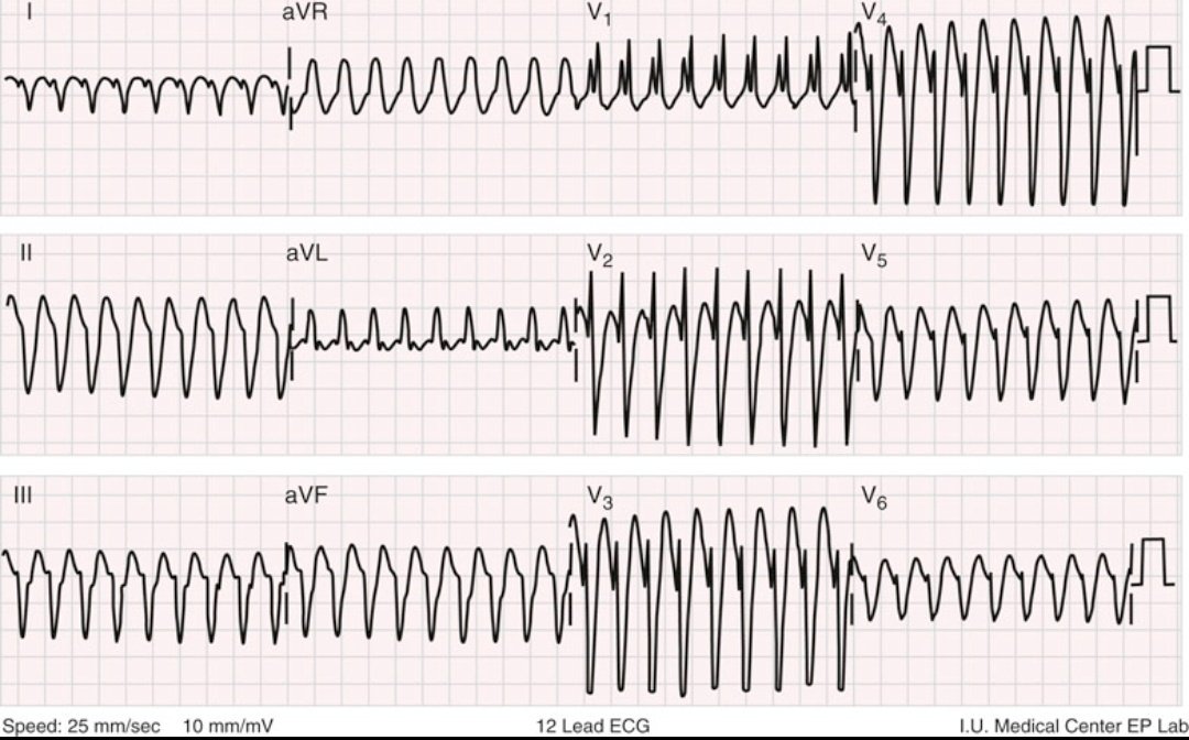 CardiovascularCorner tweet media