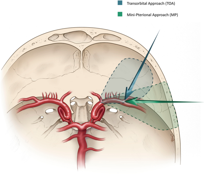 Acta Neurochirurgica tweet media