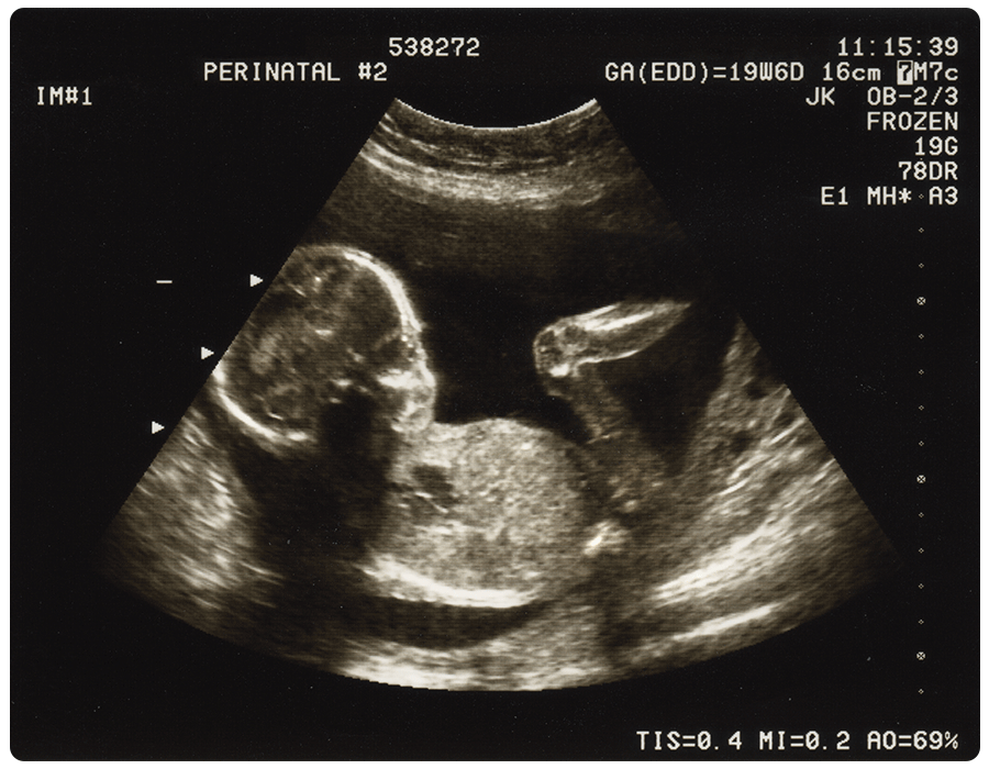 Brian Atlas tweet media