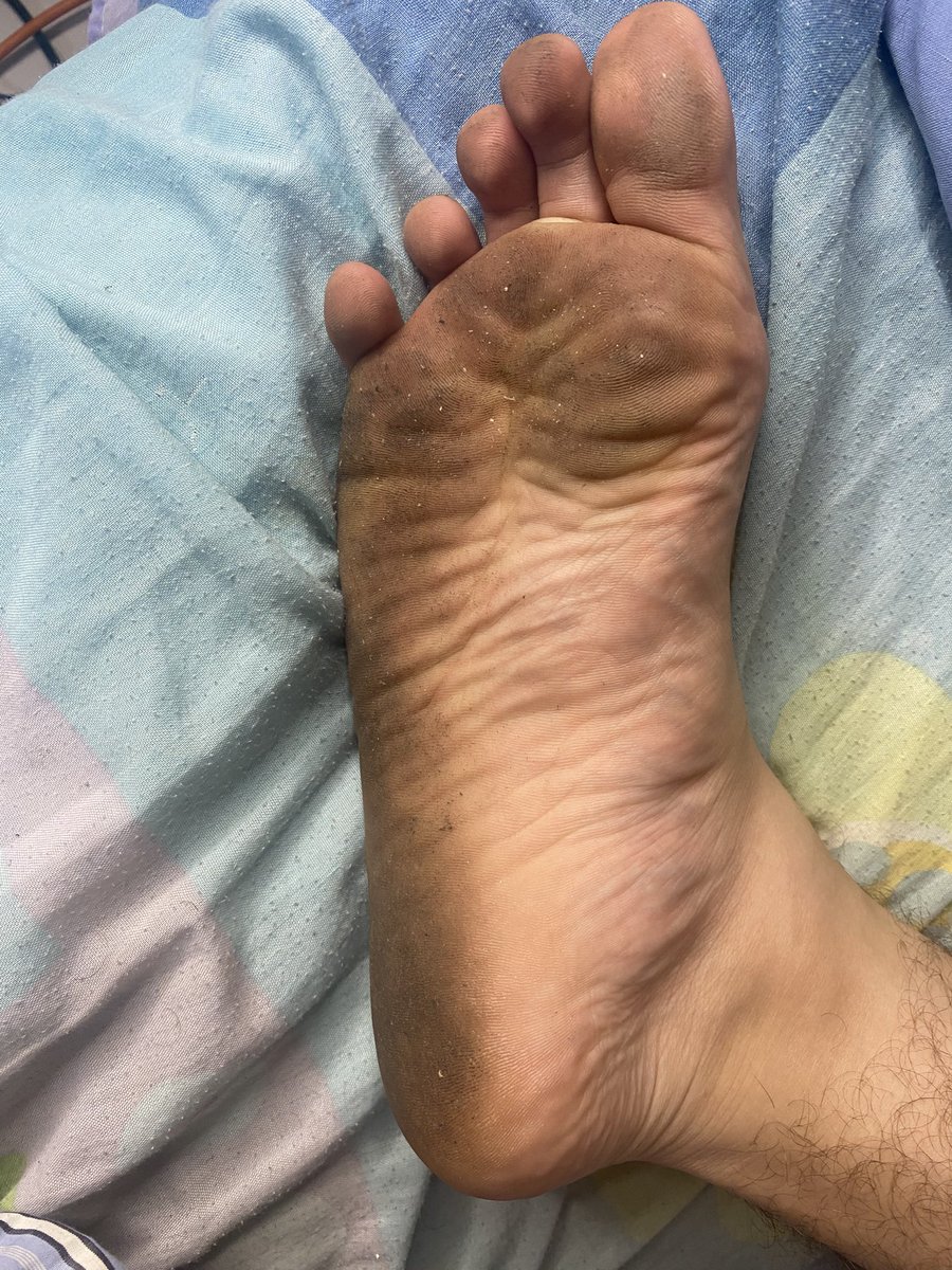 Feet4all tweet media