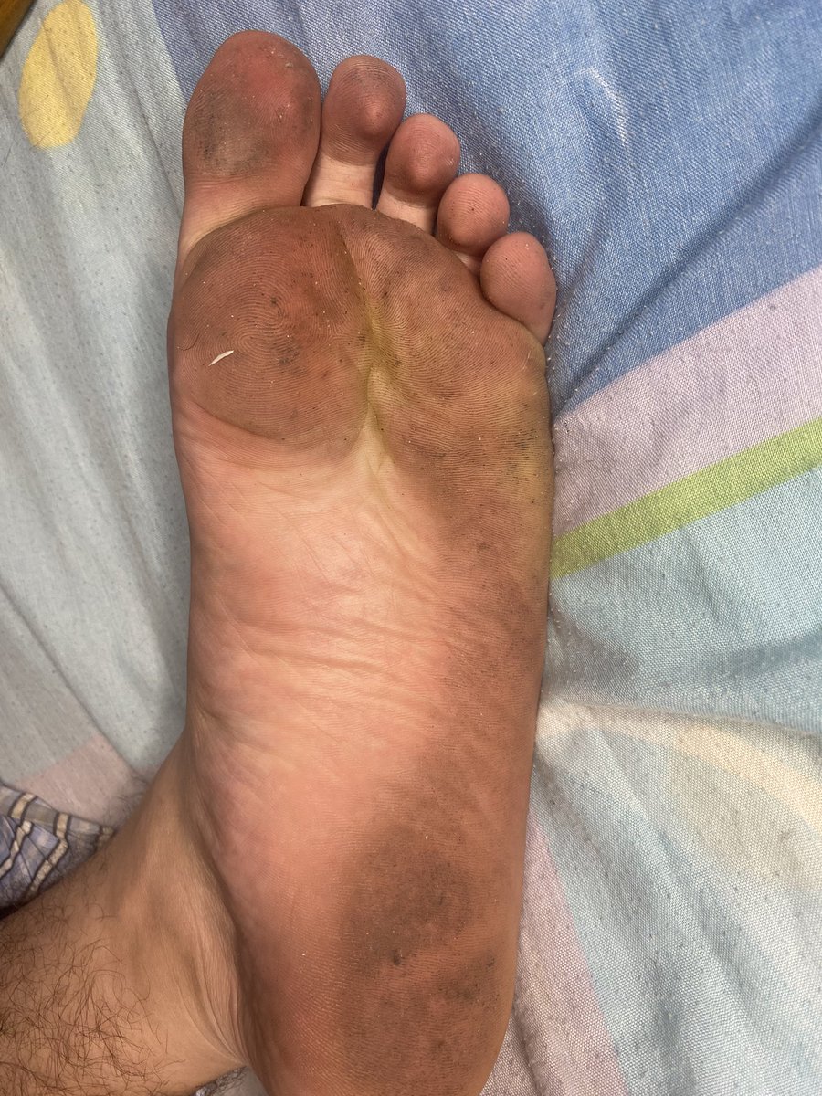 Feet4all tweet media