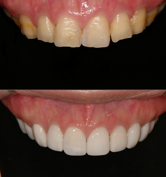 【公式】ル歯科 カンナム歯医者(le:dental clinic) tweet media