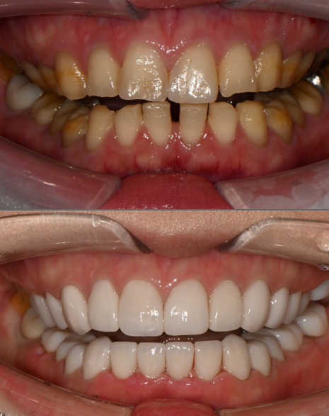 【公式】ル歯科 カンナム歯医者(le:dental clinic) tweet media