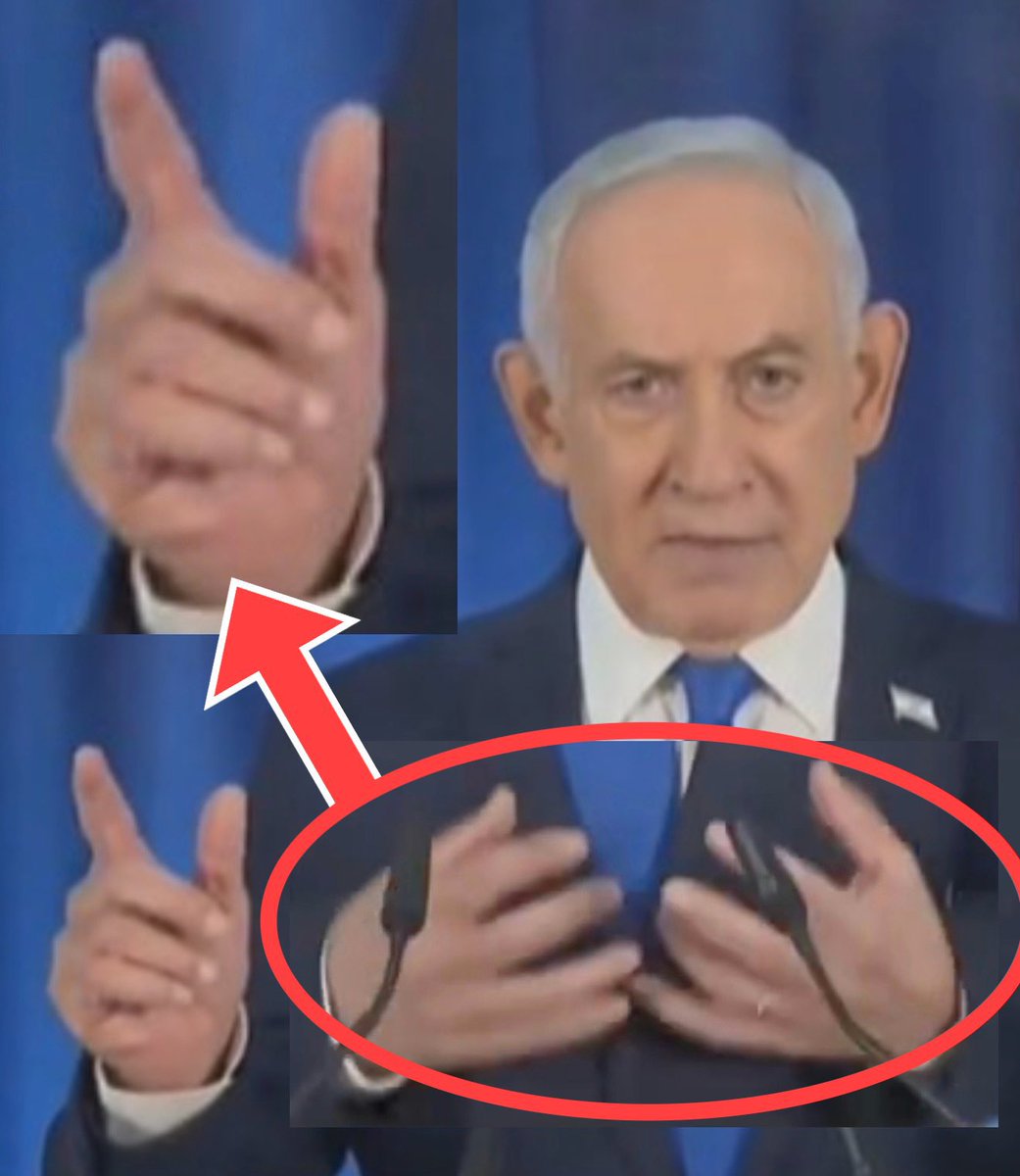 Jakartalk's tweet photo. 🚨HOT NEWS: Perdana menteri Israel (Benjamin Netanyahu) yang dikabarkan tewas beberapa hari lalu karena serangan udara militer Iran akhirnya muncul ke publik. Tapi jarinya nambah 1. https://t.co/beCl61Kerl