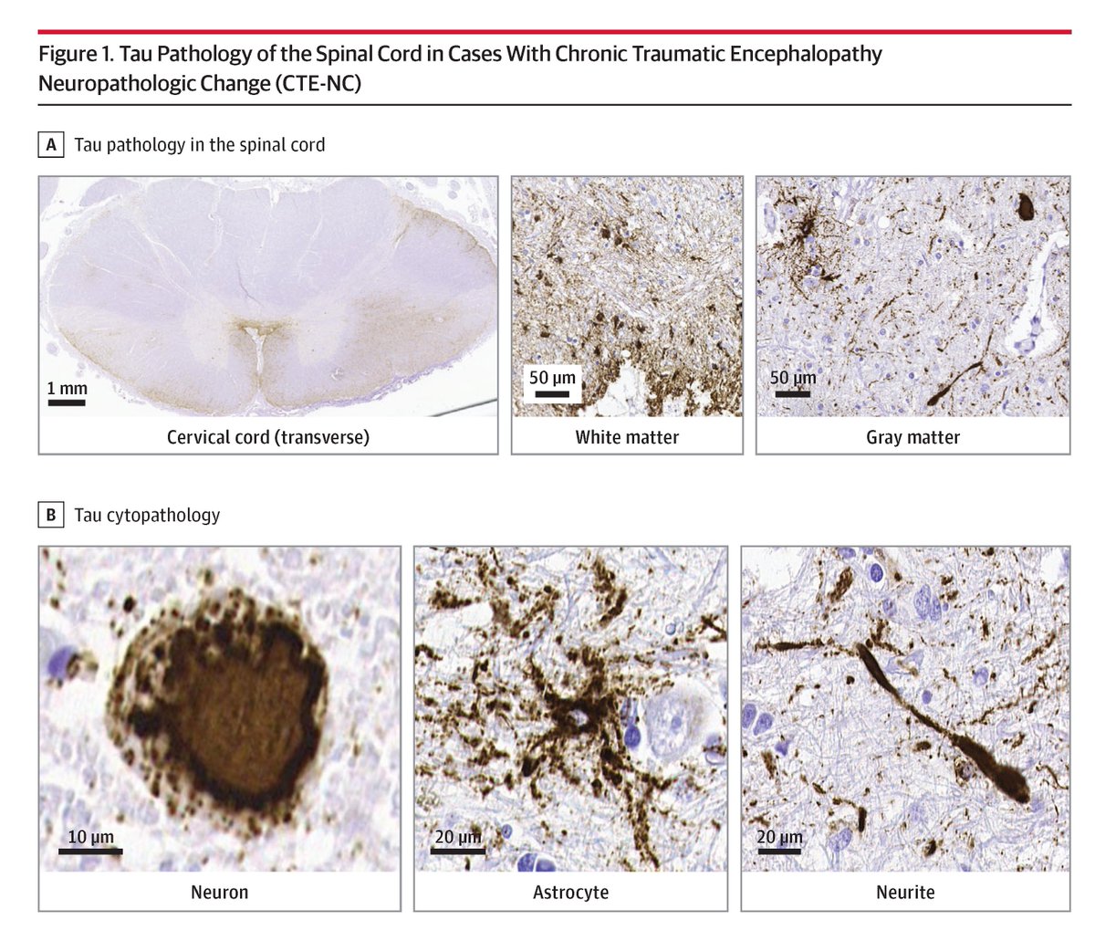 JAMA Neurology tweet media