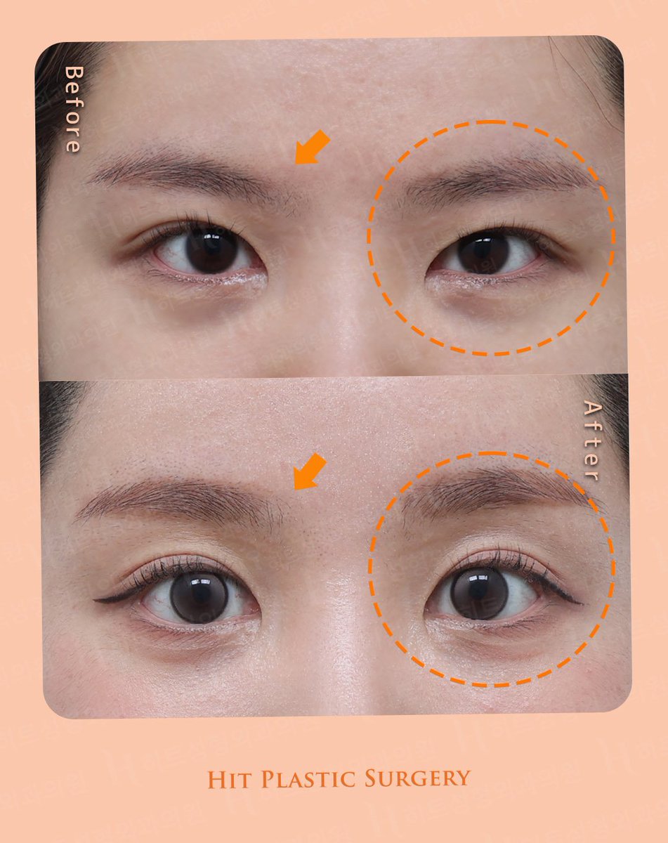 ヒット整形外科 tweet media