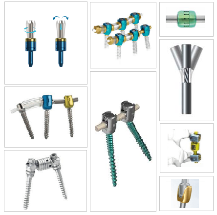 From Early Innovations to Modern Practice: Where Are Dynamic and Semi-Rigid Spine Systems Today?
thespinemarketgroup.com/from-early-inn…