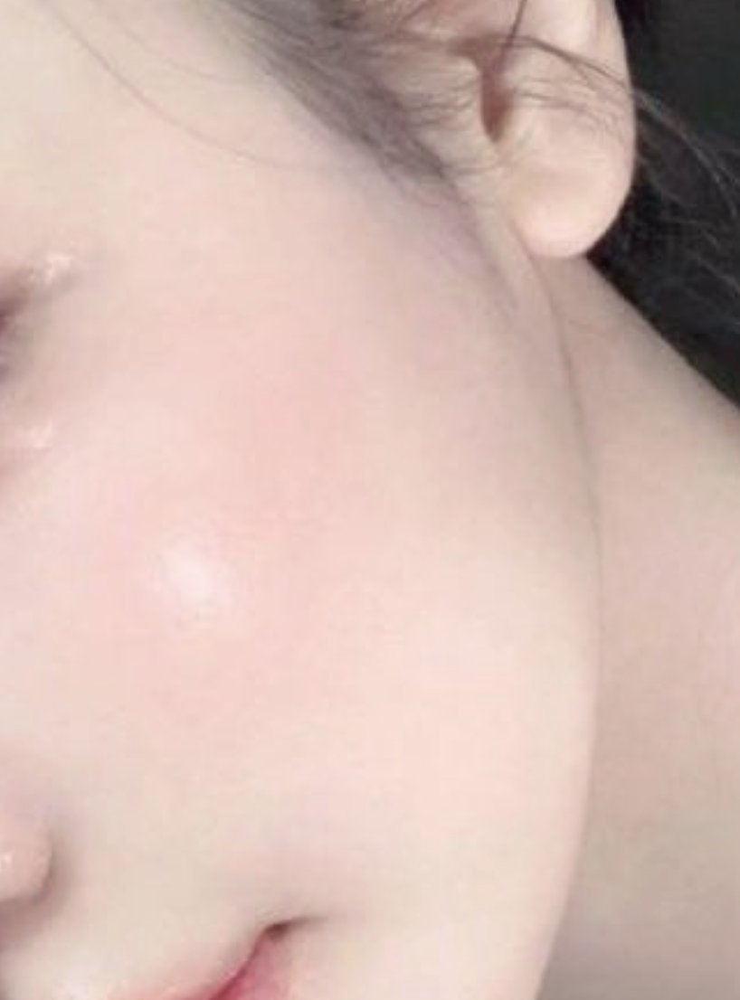 肌管理ほんとに一番やってよかったのは、水光注射。
ダウンタイムもそんな長くないし肌が内側から発光しはじめてテンションもメイクモチベも上がった🥹💗