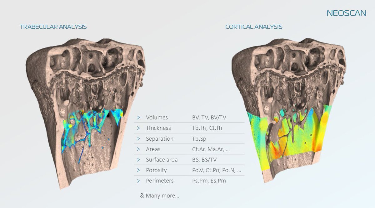 Wonderful_Sci's tweet image. 📢New software from #NeoScan: Bone Analysis Module 🔬🦴

Designed to streamline advanced #boneresearch workflows, with 3D histomorphometry for both cortical &amp;amp; trabecular bone.

Built in line with #ASBMR guidelines for robust, standardised analysis.

✉️info@wonderfulscientific.com