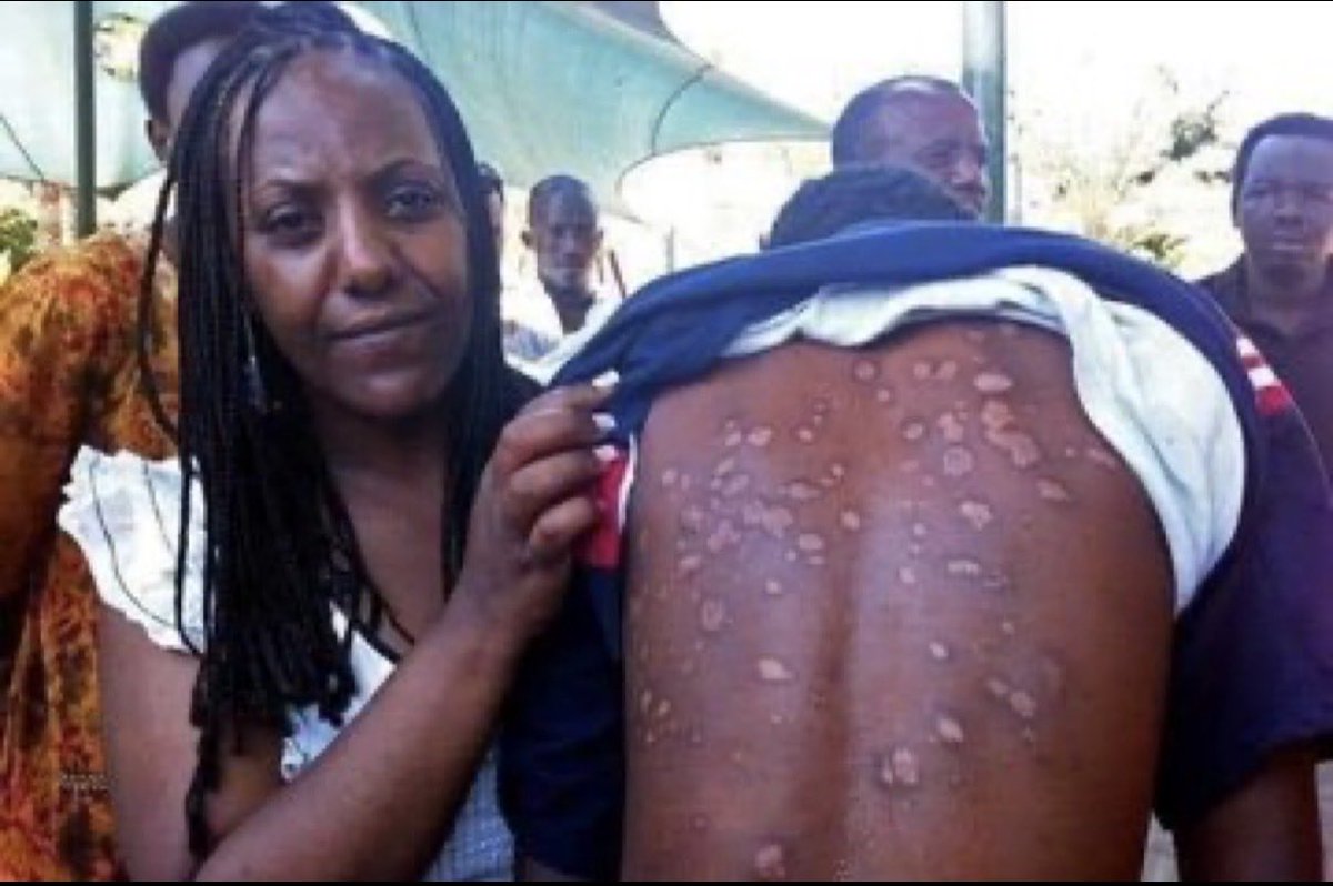 ናተይ ወለዶ💙 tweet media