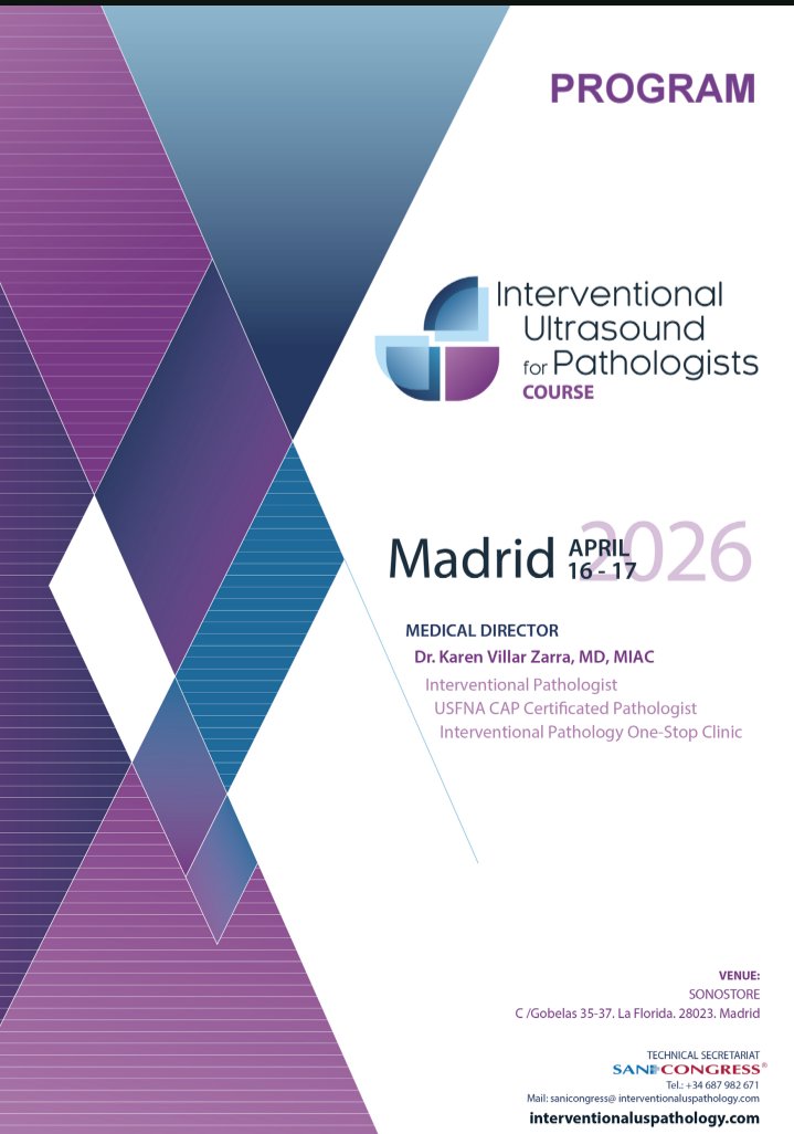 🤏🏽 Thickened mucosa of the cavum ➕ enlarged cervical lymph node.
💉 Ultrasound guided fna performed by Interventional Pathologist
2️⃣5️⃣ G.
2️⃣ Passes.
🔬 Metastatic Squamous Cell Carcinoma.

✅ Interventional Ultrasound for Pathologists course
🔗 interventionaluspathology.com
#FNAfriday