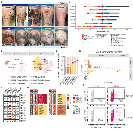 SaligramaLab's tweet image. This will soon be online as #preprint. Collaboratively, our first attempt to understand #tumor #response upon #oncolytic #virus #TVEC #therapy in #melanoma by a brilliant student in our lab...a thread 🧵