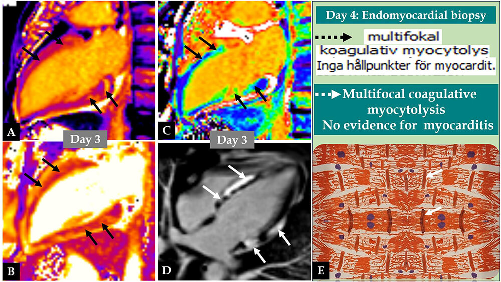 Reviews in Cardiovascular Medicine tweet media