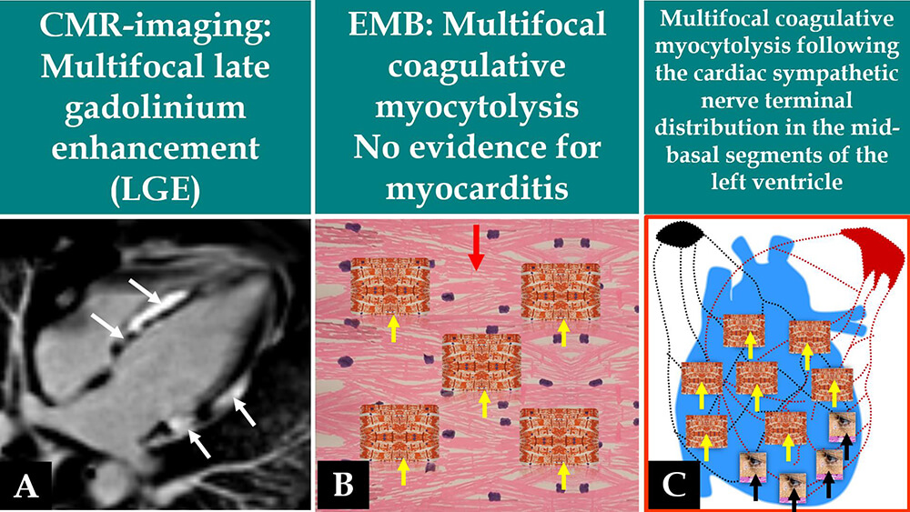 Reviews in Cardiovascular Medicine tweet media