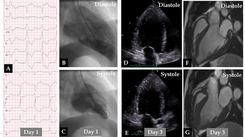 Reviews in Cardiovascular Medicine tweet media