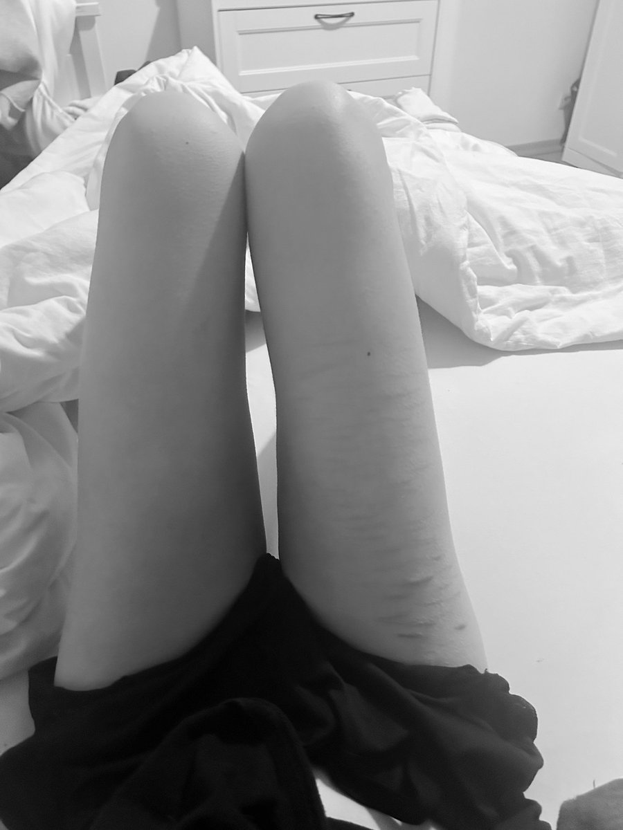 𝐰𝐢𝐧𝐧𝐢𝐞 ♡⸝⸝ tweet media