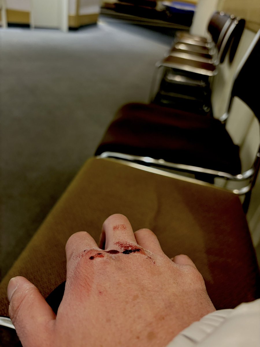 またしょうもない人間達が会社に来た
神避使えたら楽やのに
近しい事したからおまわりさん同行で病院へ
またボルト入れなあかんかも
日常って疲れますね

そんなこんなで
神避セット一名様へw