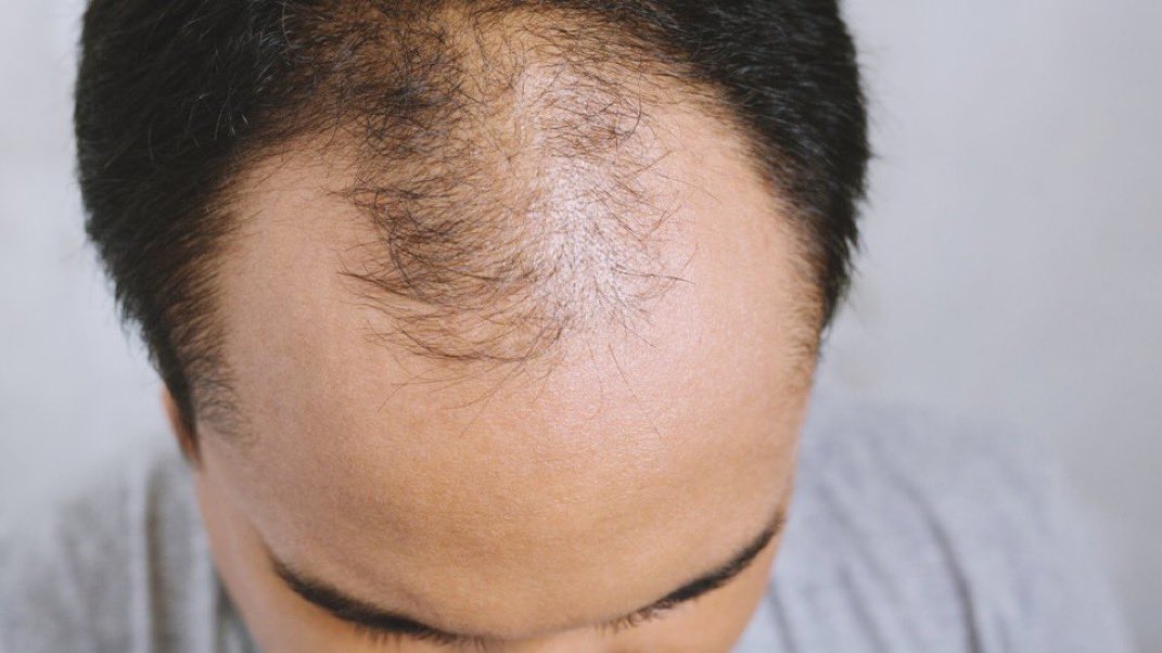 iwan Mirwan tweet media