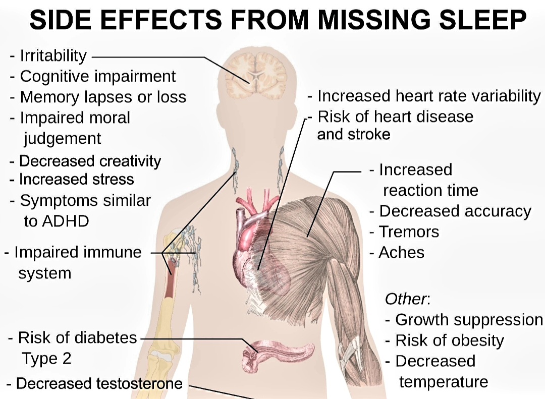 sereneKoncept's tweet photo. Crucial #sleepHealth inforgraph, how lack of sleep affects entire #bodyFunction https://t.co/X96SI15ZNI