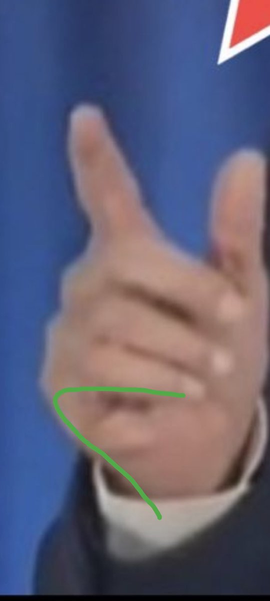hervewal's tweet photo. @swheeler31 @WaterMagister @MattWallace888 @grok Trust what you want 🤣
It is a simple shadow and the hand has an angle. Simple visual perception 🤷
Green line shows external shape of hand. https://t.co/FPEXB5M52Y