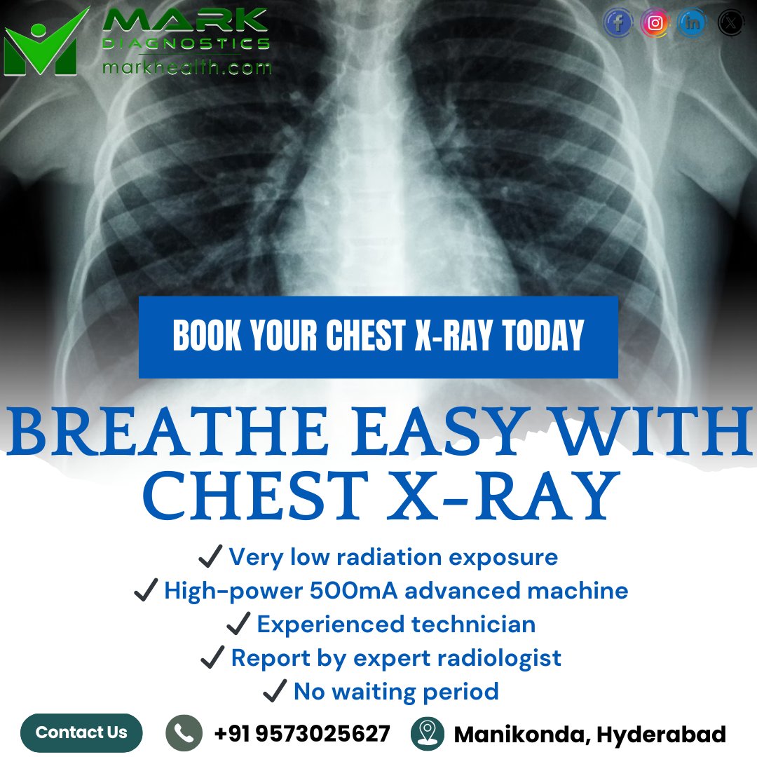 MarkDiagnostics's tweet image. Breathe Easy with a Chest X-Ray.
Low radiation imaging, expert reporting, and quick results at Mark Diagnostics.
📍 Manikonda, Hyderabad
📞 +91 9573025627
#MarkDiagnostics #ChestXray #Healthcare #Diagnostics #Manikonda #Hyderabad