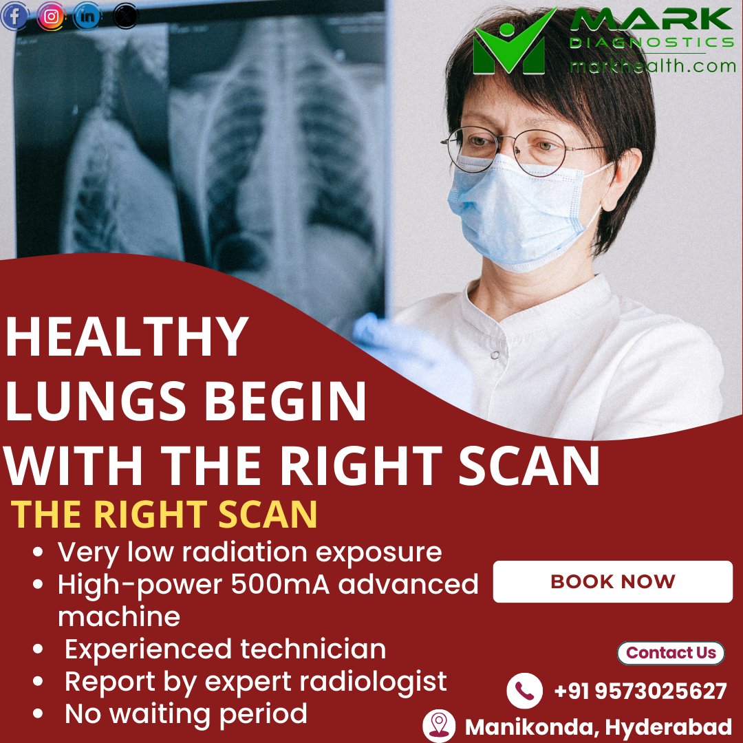 MarkDiagnostics's tweet image. Healthy lungs start with the right scan.
Get a Chest X-Ray with low radiation and quick results at Mark Diagnostics.
📍 Manikonda, Hyderabad
📞 +91 9573025627
#MarkDiagnostics #ChestXray #Healthcare #Diagnostics #Manikonda #Hyderabad