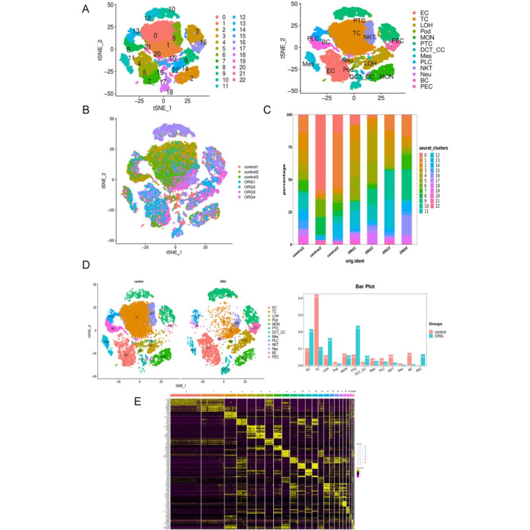 GenesNDiseases's tweet photo. Researchers use #SingleCellRNAseq to map #obesity-related #glomerulopathy, revealing reduced immune cells, #SPP1 upregulation in T/B cells, altered metabolic &amp; inflammatory pathways, and key podocyte–parietal epithelial interactions. @centralsouth_u

Read: https://t.co/tRE6RhGW3l https://t.co/Awbi237319