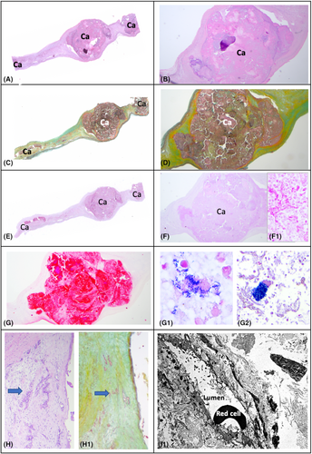 European Journal of Clinical Investigation tweet media