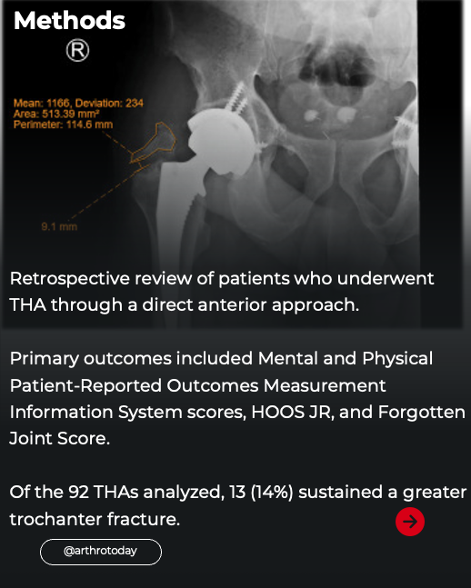 Arthroplasty Today tweet media