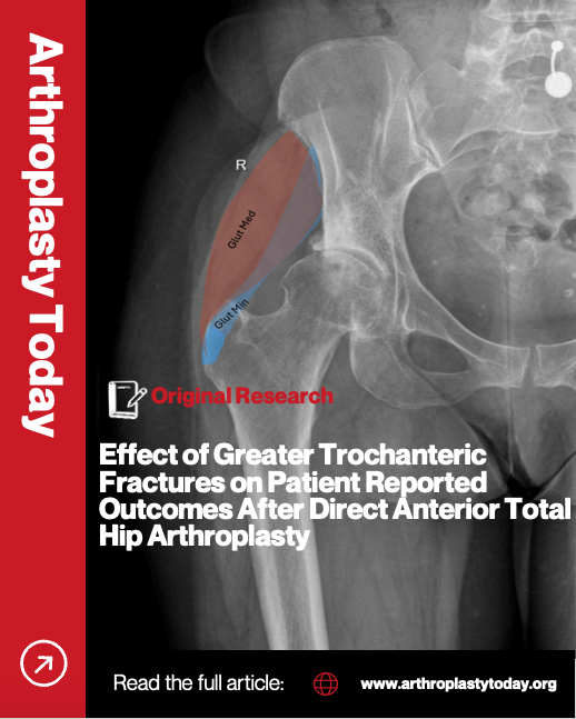 Arthroplasty Today tweet media