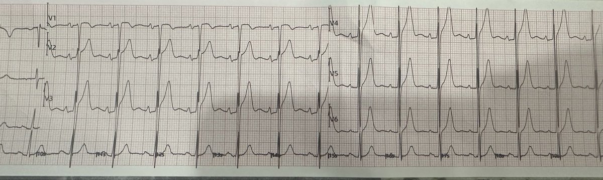 #BINIxSB19 tweet media
