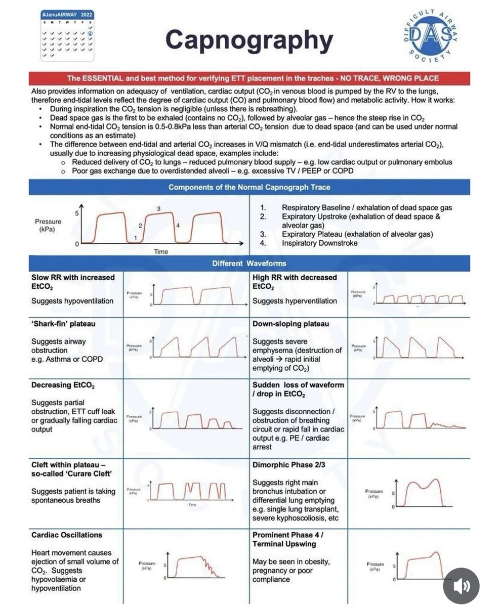 #DocenciaSEDAR | Infografía sobre capnografía

Recuerda: el método esencial para verificar la correcta colocación del ETT es la presencia de capnograma.

NO TRACE = WRONG PLACE