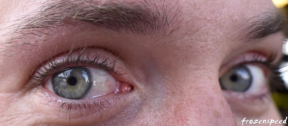 Jochen - Frozenspeed tweet media