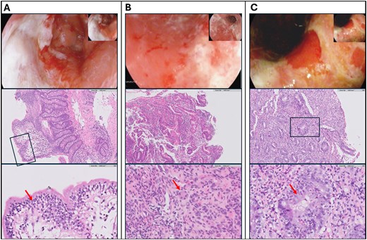 The Oncologist tweet media