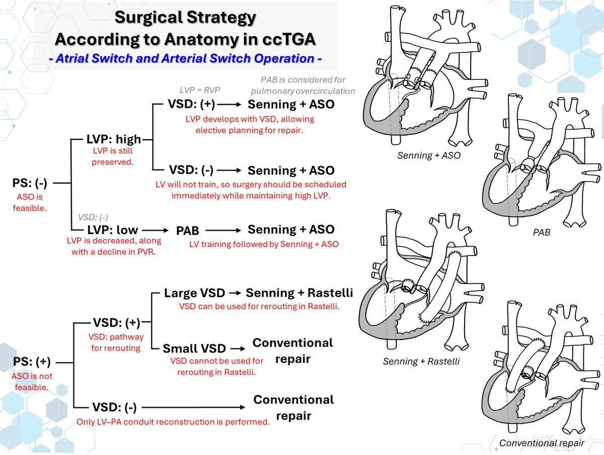 ccTGA: Surgical Strategy Overview

👉In ccTGA, operative strategy is determined primarily by PS, VSD anatomy, and LV preparedness.
👉Without PS, double switch with Senning + ASO is feasible when the LV can support systemic pressure.
👉With PS, a large VSD may allow Senning +