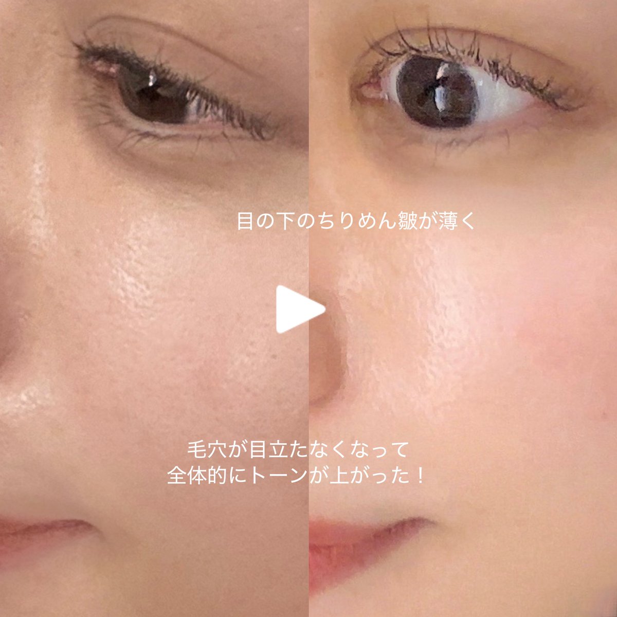 丸山悠美💍 tweet media